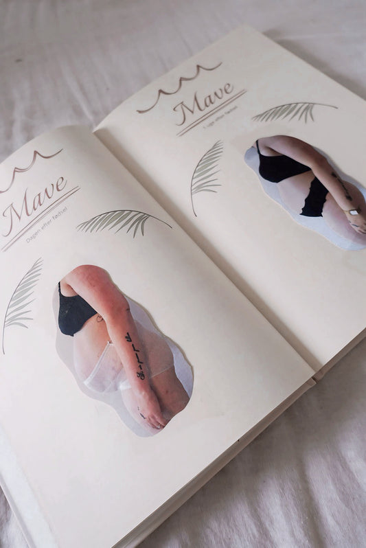 Barsel journal - Gammel udgave